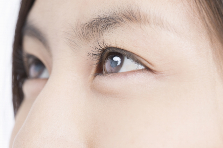 眼瞼下垂手術のダウンタイム